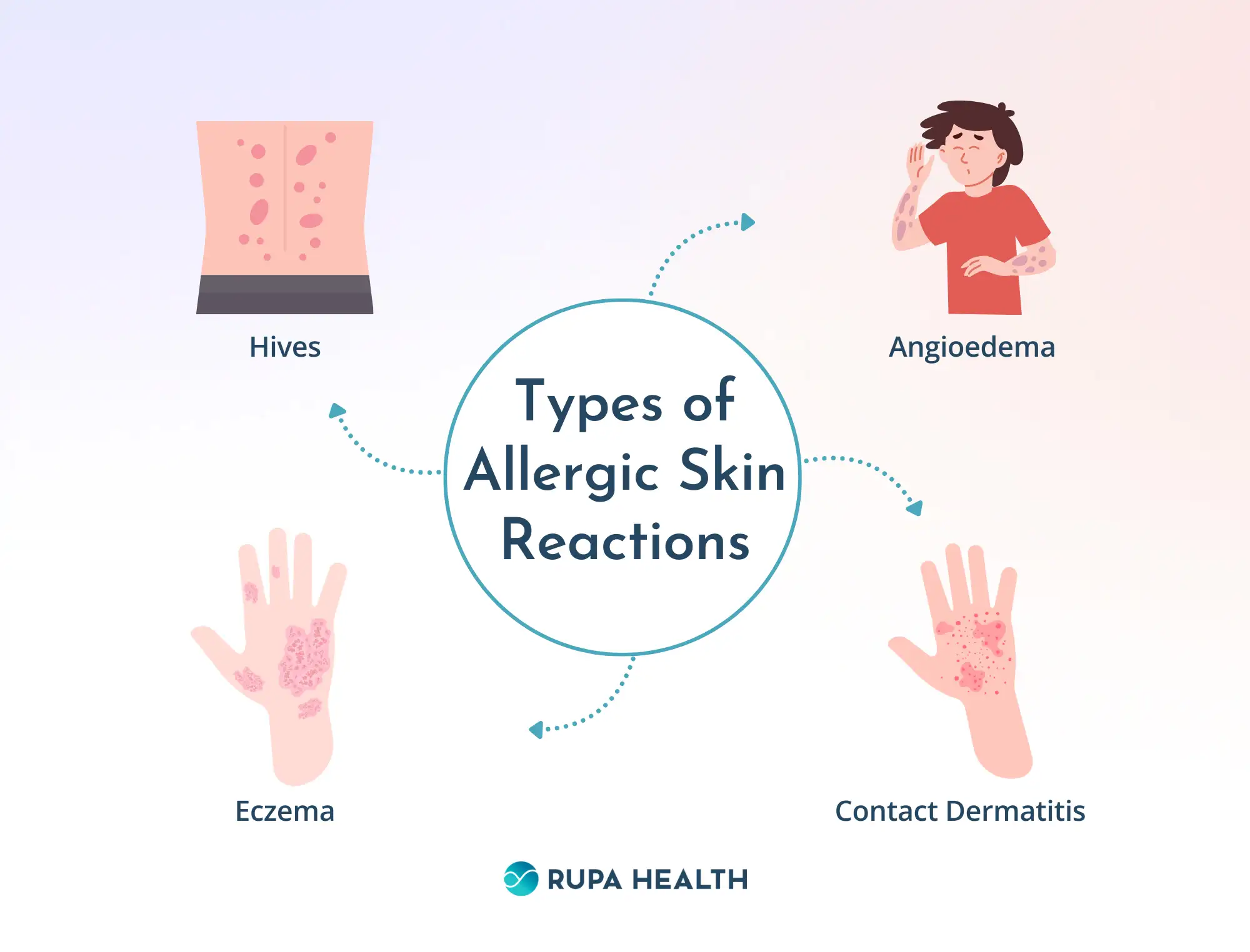 Allergen Considerations and Skin Sensitivity