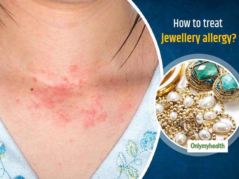 Recognizing Allergy Considerations in Jewelry